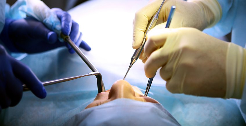 Cirugía de Implantes Dentales