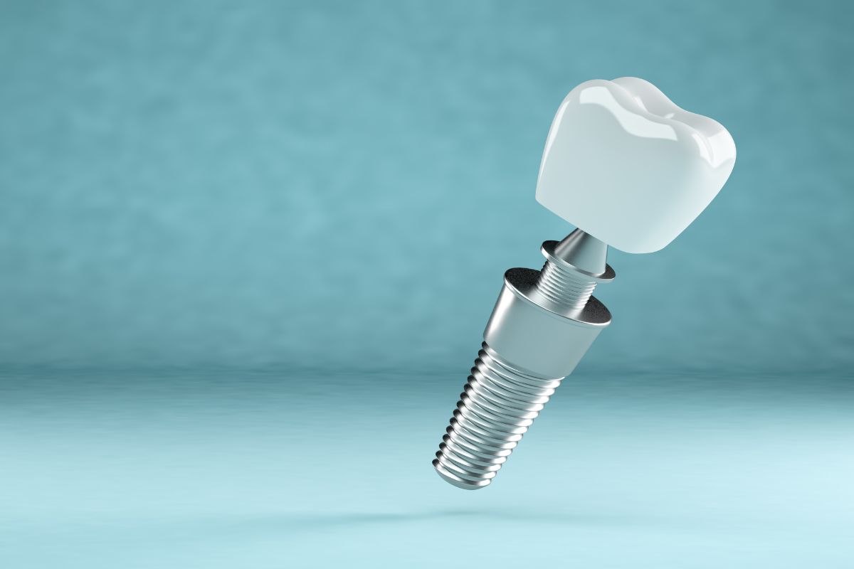Etapa de Mantención de Implantes Dentales